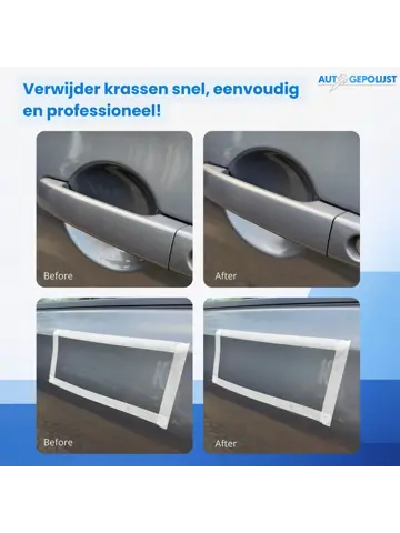 Krasverwijderaar Pro Set - Polijstset - 10 Delig